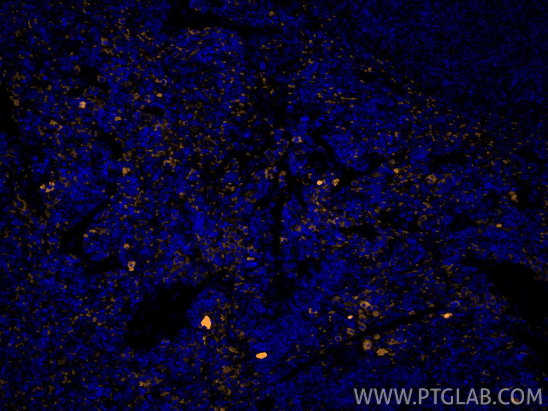 IF Staining of mouse spleen using 65205-1-Ig Immunofluorescence (IF) / fluorescent staining of mouse spleen tissue using Anti-Mouse CD8a (5H10-1) (65205-1-Ig)