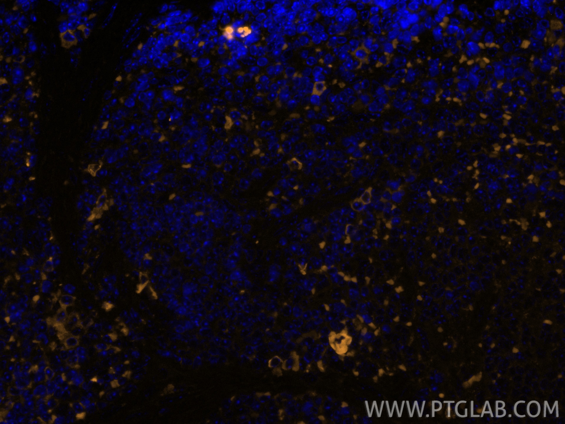 IF Staining of mouse spleen using 65205-1-Ig Immunofluorescence (IF) / fluorescent staining of mouse spleen tissue using Anti-Mouse CD8a (5H10-1) (65205-1-Ig)