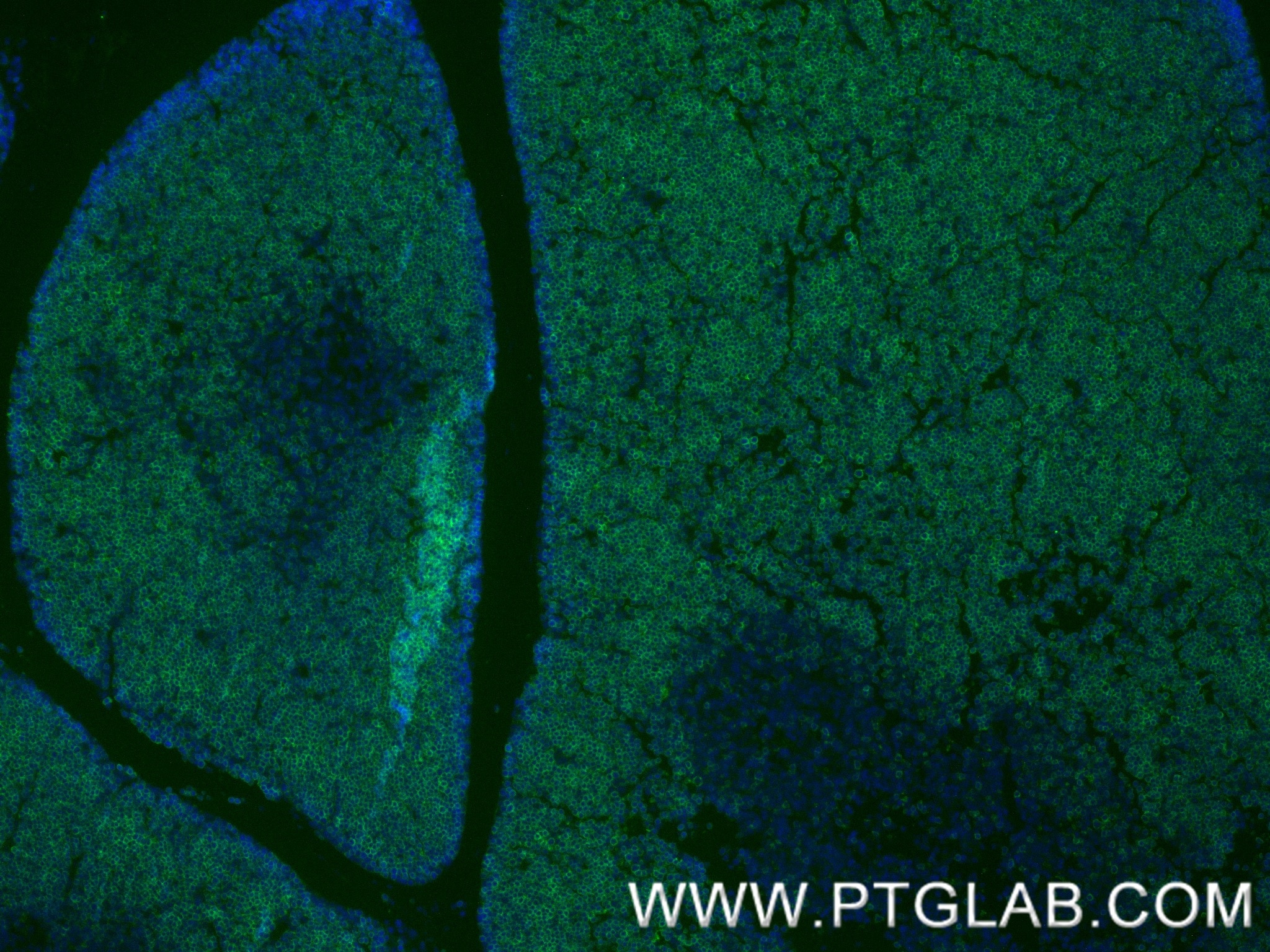 Immunofluorescence (IF) / fluorescent staining of mouse thymus tissue using CD8a Recombinant monoclonal antibody (85977-4-RR)