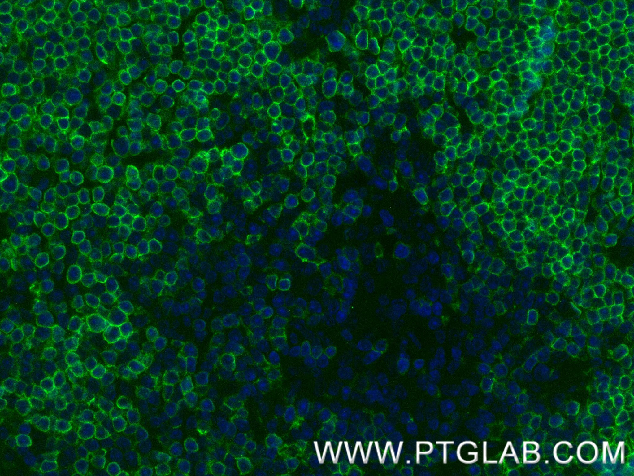 Immunofluorescence (IF) / fluorescent staining of mouse thymus tissue using CD8a Recombinant monoclonal antibody (85977-4-RR)