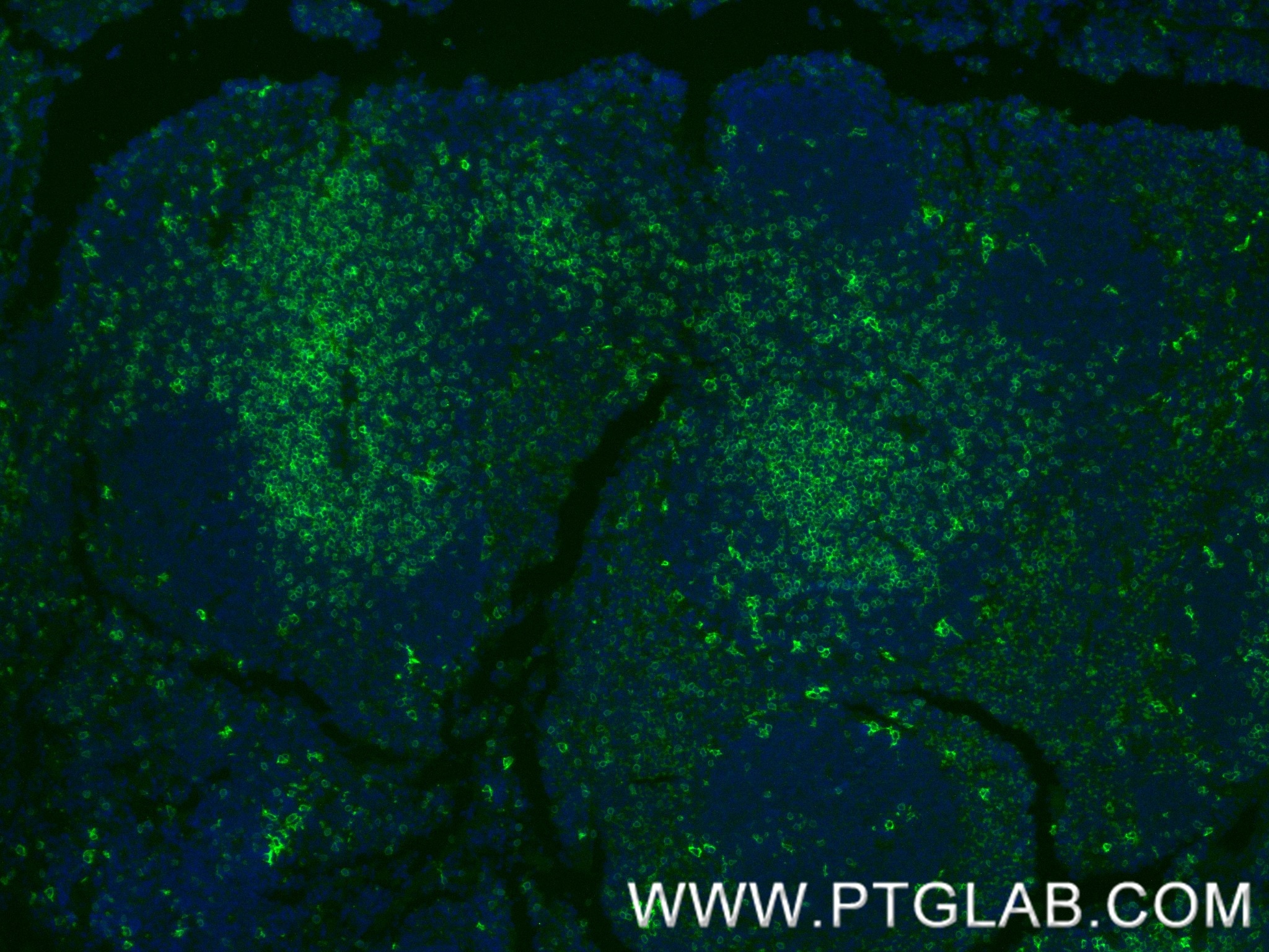 Immunofluorescence (IF) / fluorescent staining of mouse spleen tissue using CD8a Recombinant monoclonal antibody (85977-4-RR)