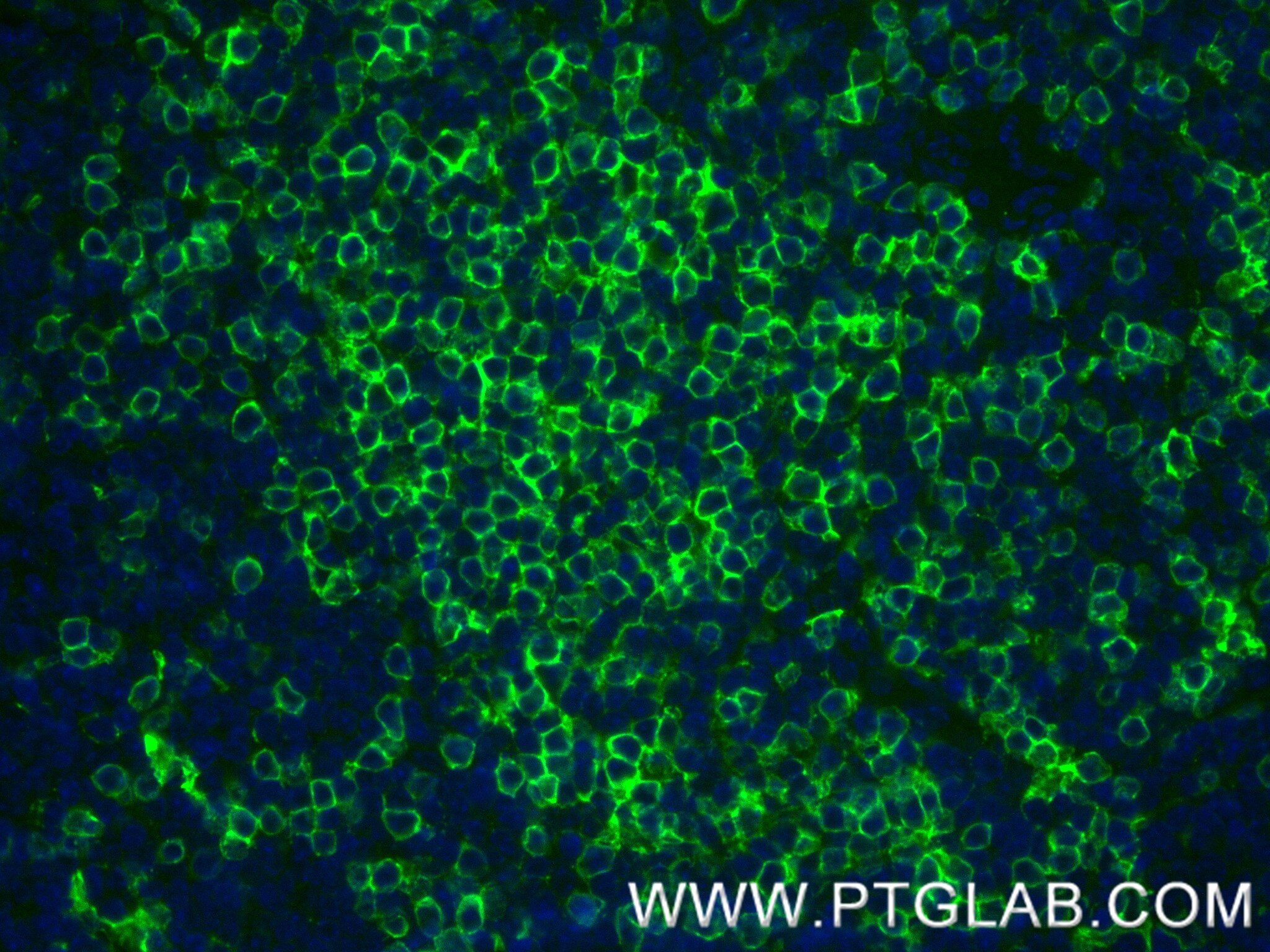 Immunofluorescence (IF) / fluorescent staining of mouse spleen tissue using CD8a Recombinant monoclonal antibody (85977-4-RR)