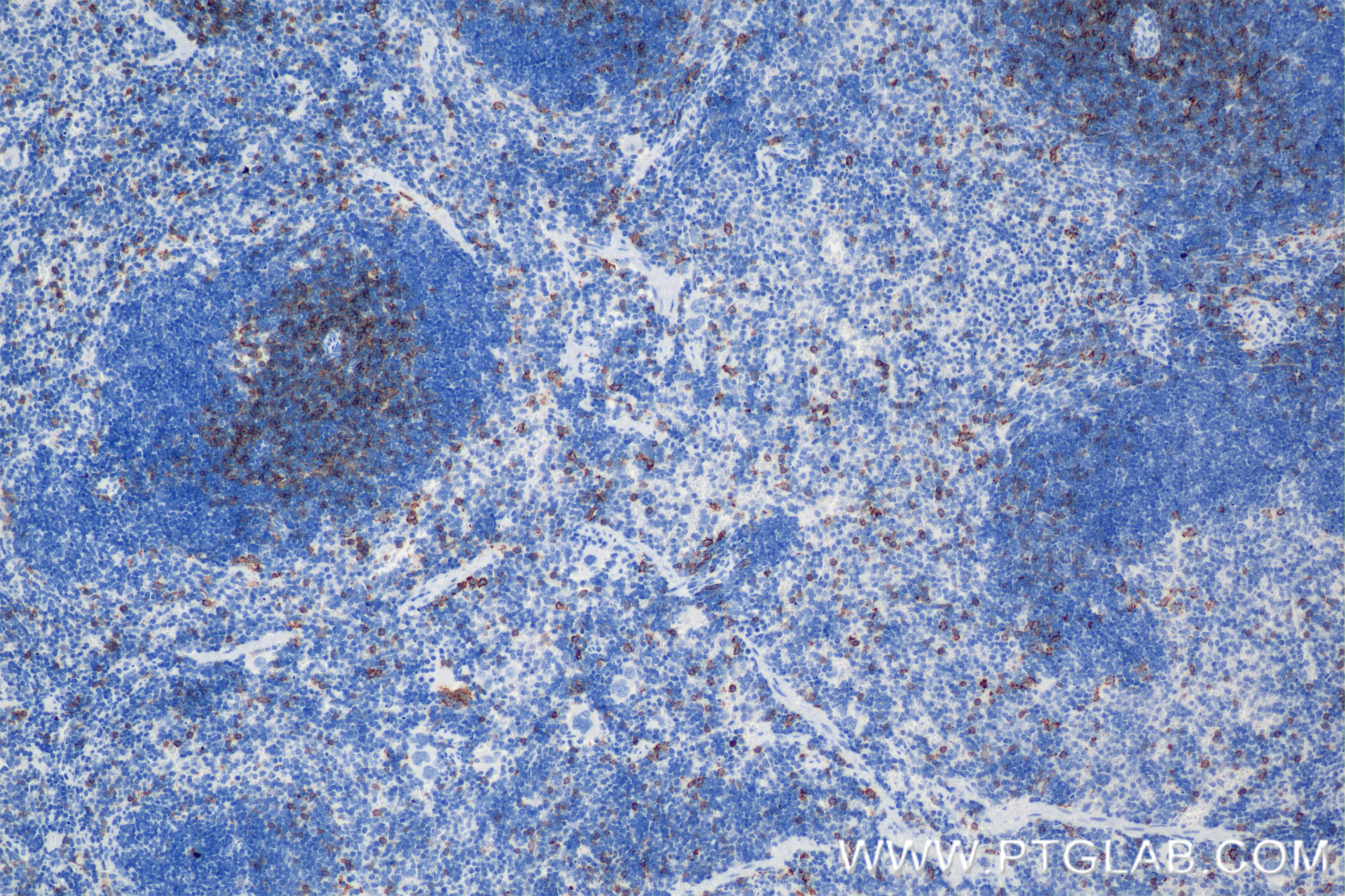 Immunohistochemistry (IHC) staining of mouse spleen tissue using CD8a Recombinant antibody (85977-4-RR)