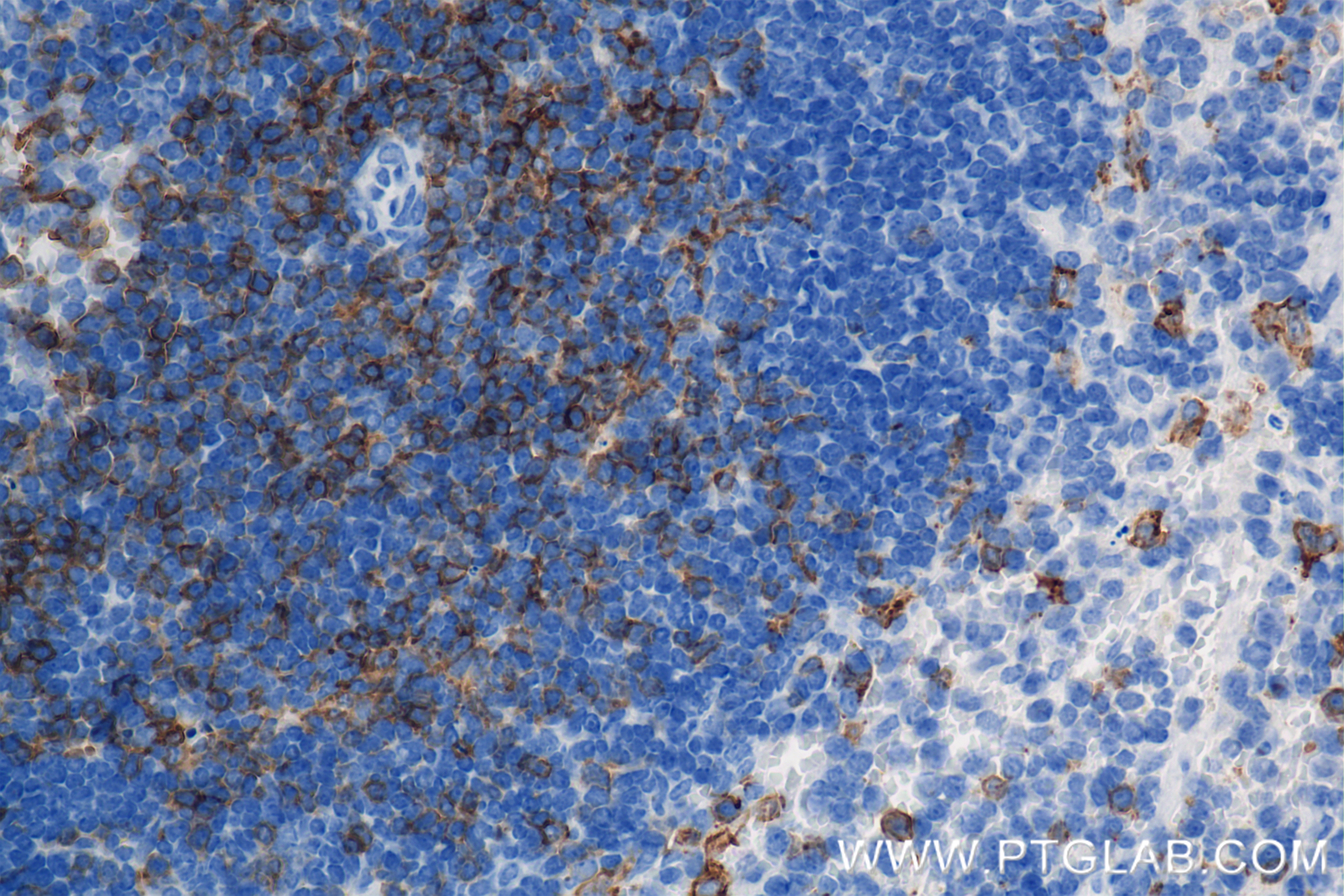 Immunohistochemistry (IHC) staining of mouse spleen tissue using CD8a Recombinant antibody (85977-4-RR)