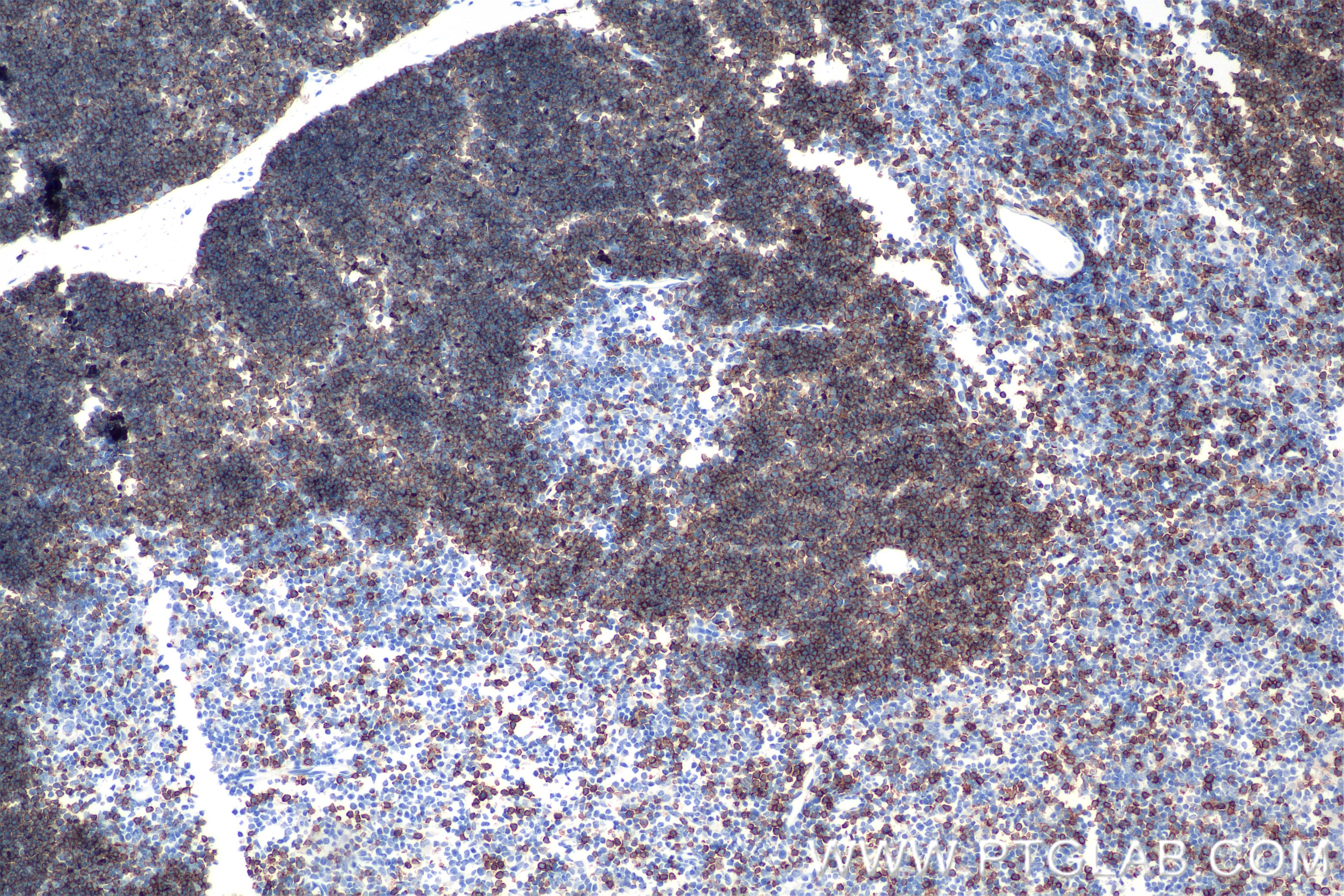 Immunohistochemistry (IHC) staining of mouse thymus tissue using CD8a Recombinant antibody (85977-4-RR)