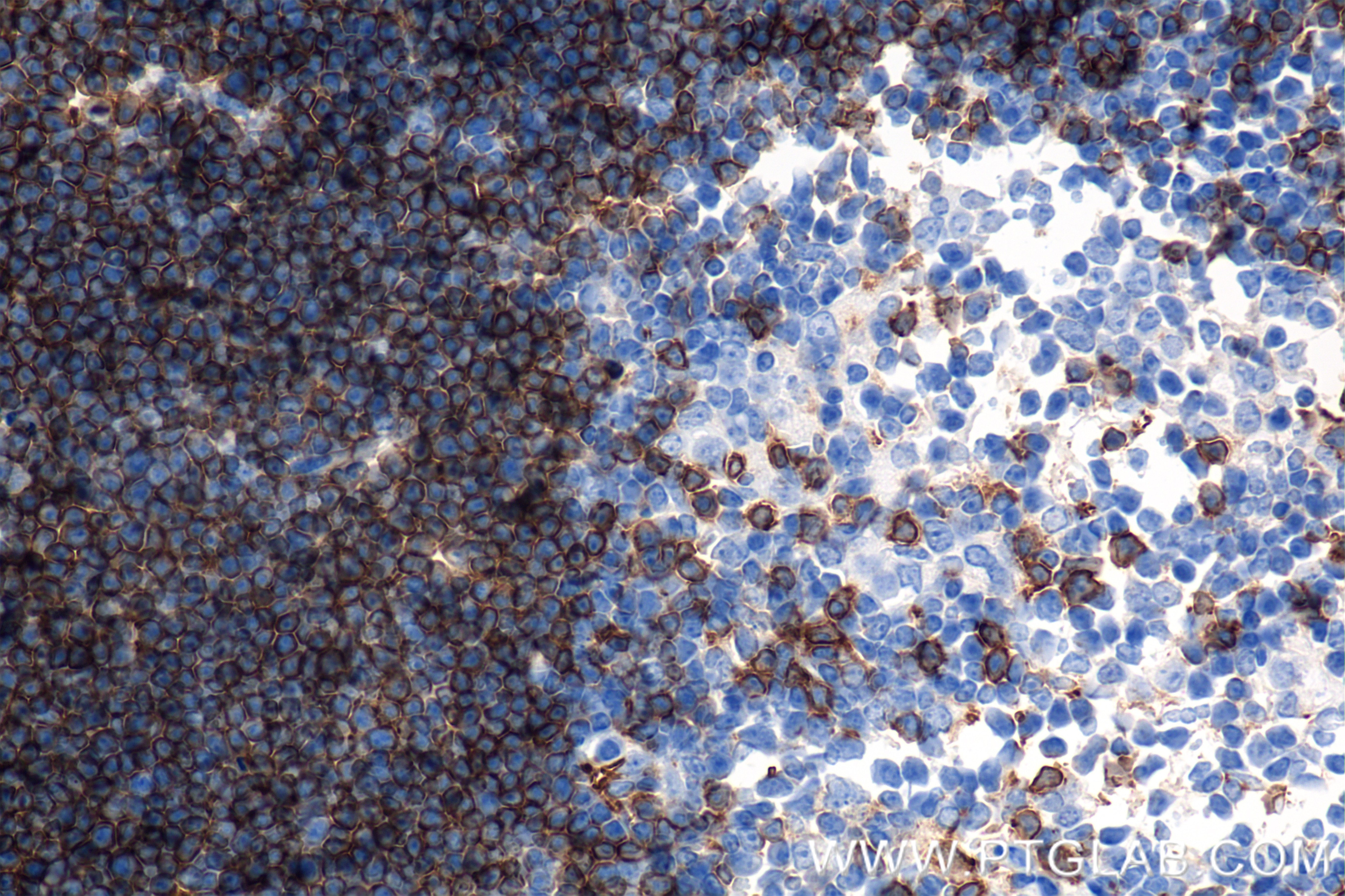 Immunohistochemistry (IHC) staining of mouse thymus tissue using CD8a Recombinant antibody (85977-4-RR)