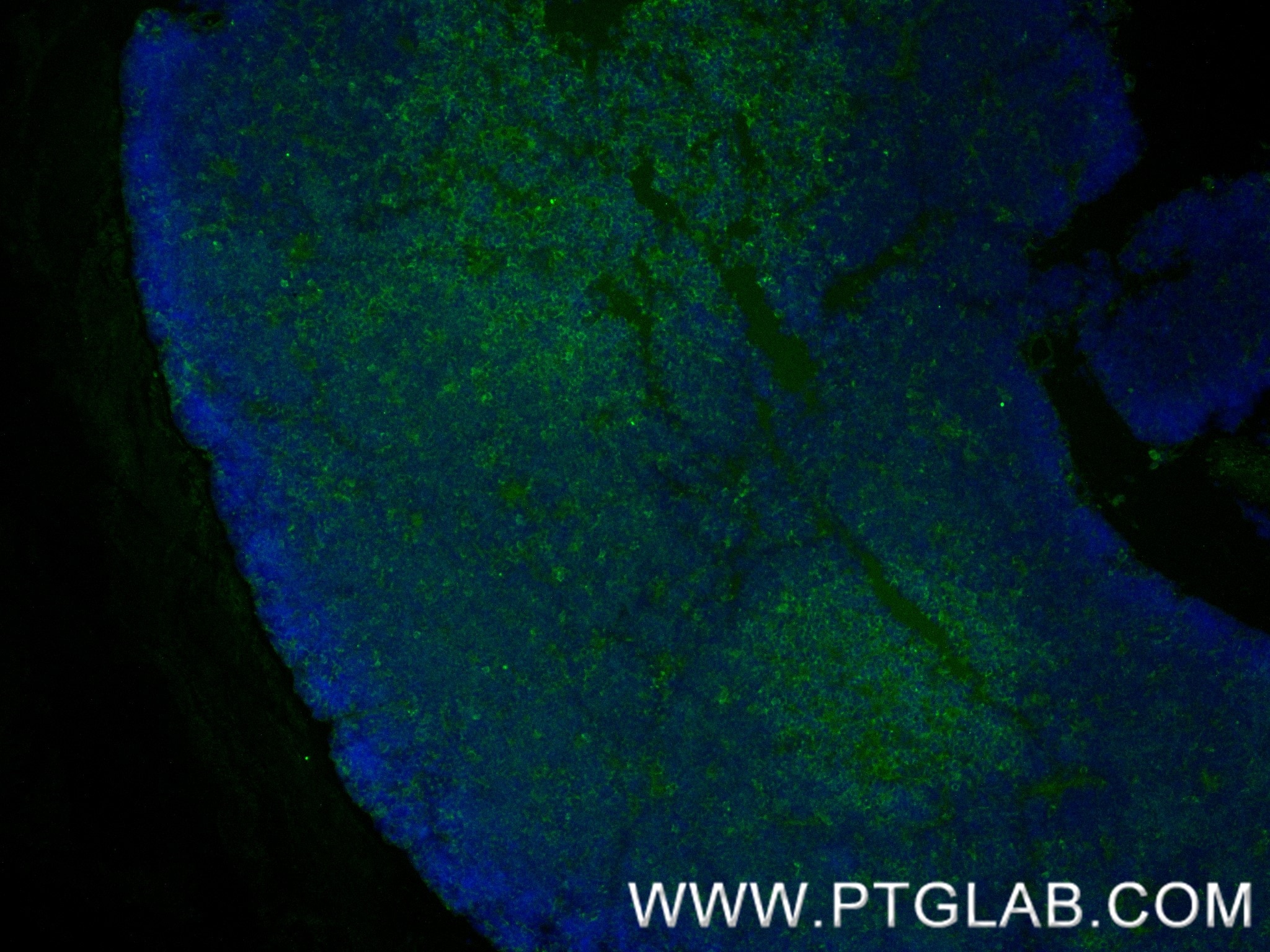 Immunofluorescence (IF) / fluorescent staining of mouse thymus tissue using CD8a Recombinant antibody (86063-1-RR)