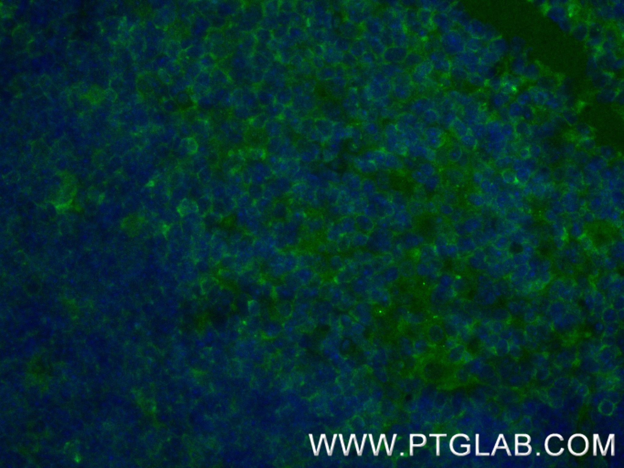 Immunofluorescence (IF) / fluorescent staining of mouse thymus tissue using CD8a Recombinant antibody (86063-1-RR)