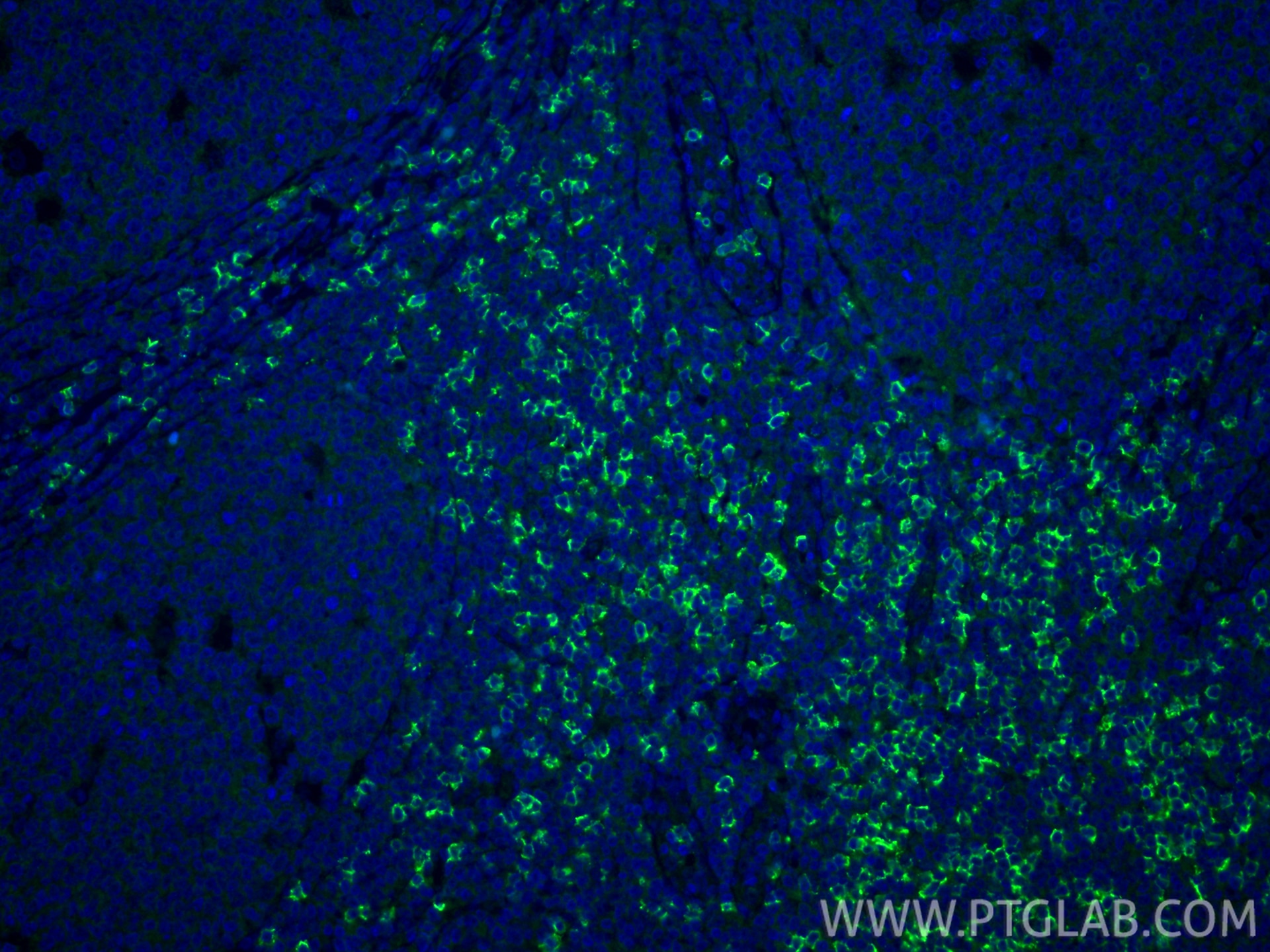 IF Staining of human tonsillitis using 86063-2-RR Immunofluorescence (IF) / fluorescent staining of human tonsillitis tissue using CD8a Recombinant monoclonal antibody (86063-2-RR)