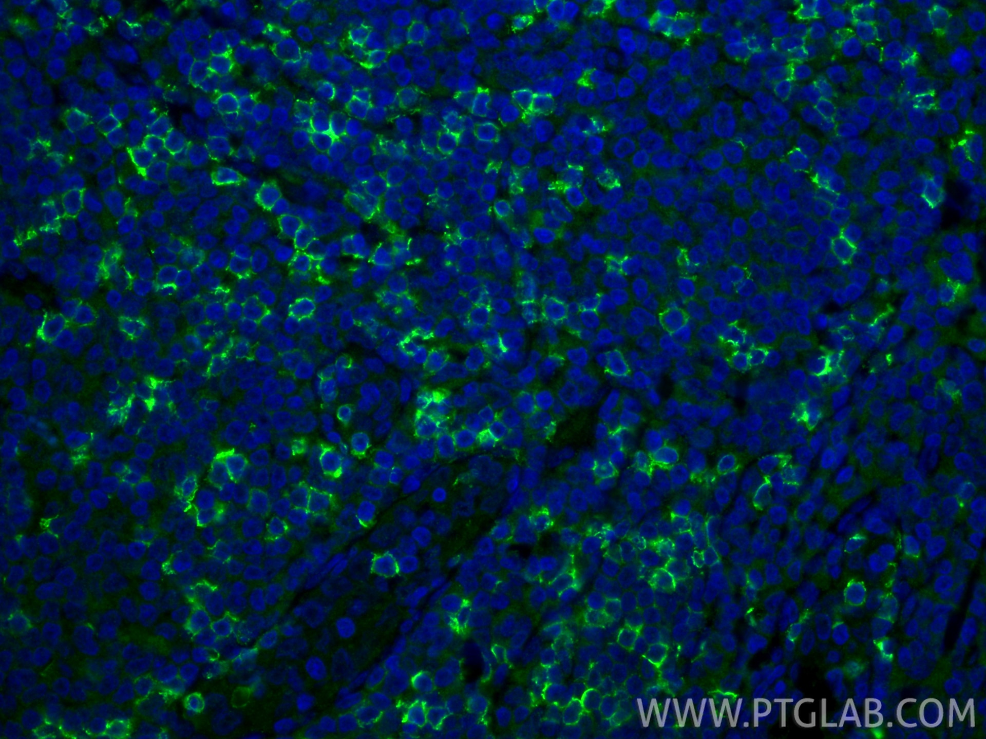 IF Staining of human tonsillitis using 86063-2-RR Immunofluorescence (IF) / fluorescent staining of human tonsillitis tissue using CD8a Recombinant monoclonal antibody (86063-2-RR)