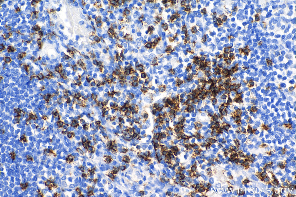 Immunohistochemistry (IHC) staining of human tonsillitis tissue using CD8a Recombinant antibody (86063-2-RR)