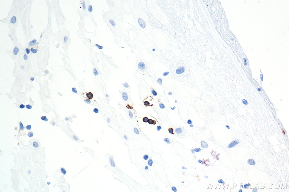 Immunohistochemistry (IHC) staining of human placenta tissue using CD8a Recombinant antibody (86063-2-RR)