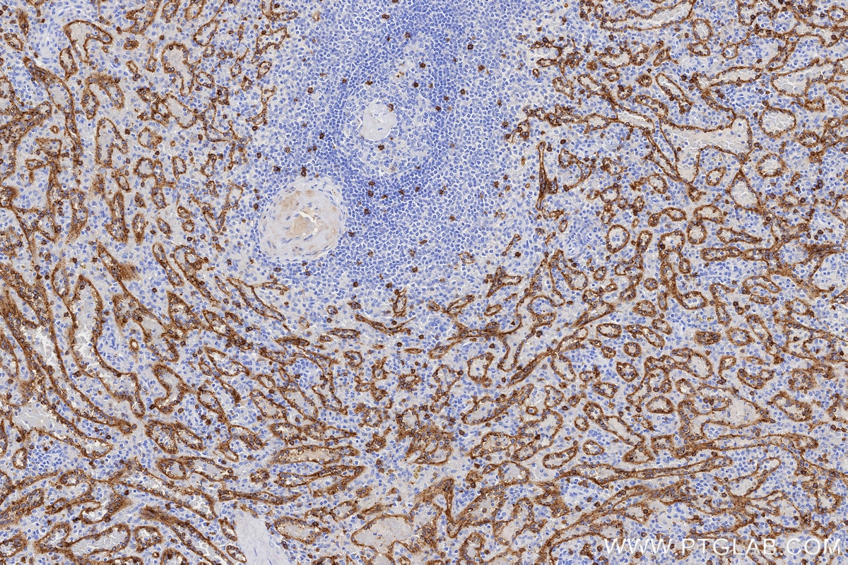 IHC staining of human spleen using 86063-2-RR Immunohistochemistry (IHC) staining of human spleen tissue using CD8a Recombinant monoclonal antibody (86063-2-RR)