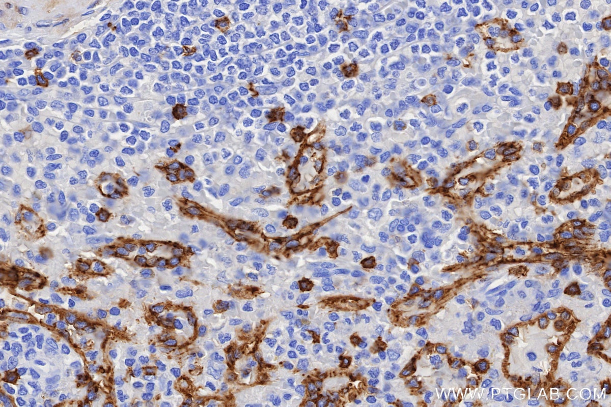 IHC staining of human spleen using 86063-2-RR Immunohistochemistry (IHC) staining of human spleen tissue using CD8a Recombinant monoclonal antibody (86063-2-RR)