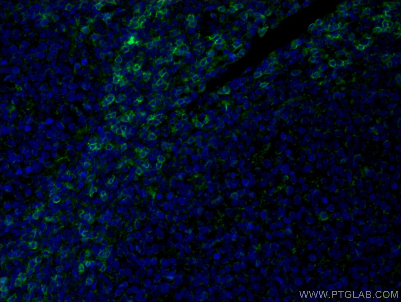 Immunofluorescence (IF) / fluorescent staining of human tonsillitis tissue using CoraLite® Plus 488-conjugated CD8a Monoclonal anti (CL488-66868)