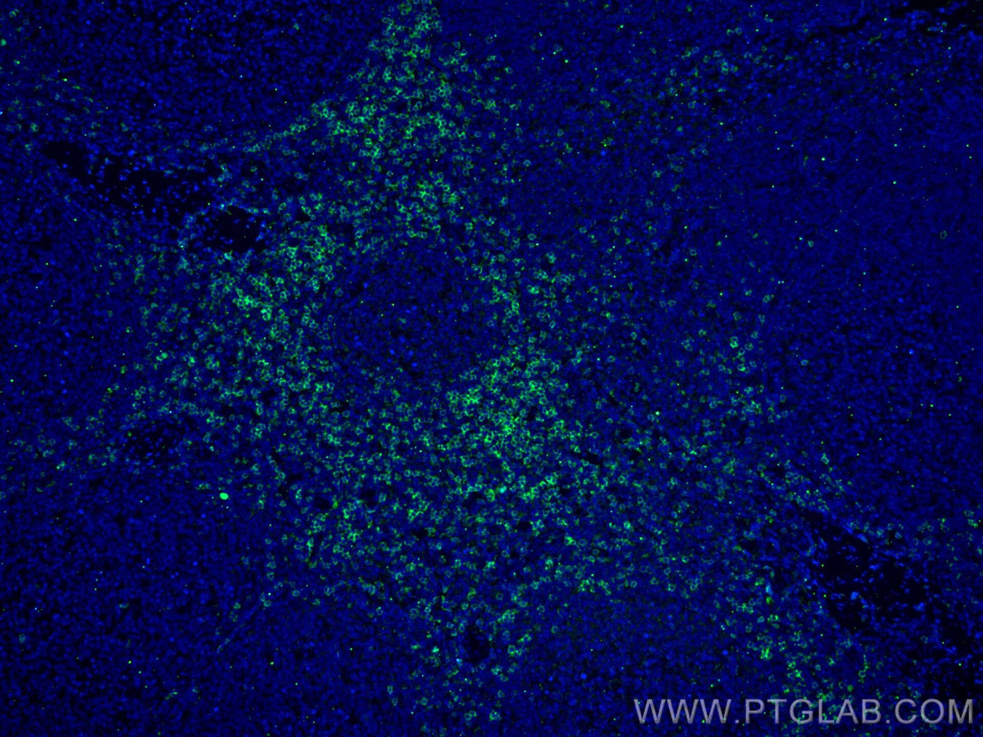 Immunofluorescence (IF) / fluorescent staining of human tonsillitis tissue using CoraLite® Plus 488-conjugated CD8a Monoclonal anti (CL488-66868)