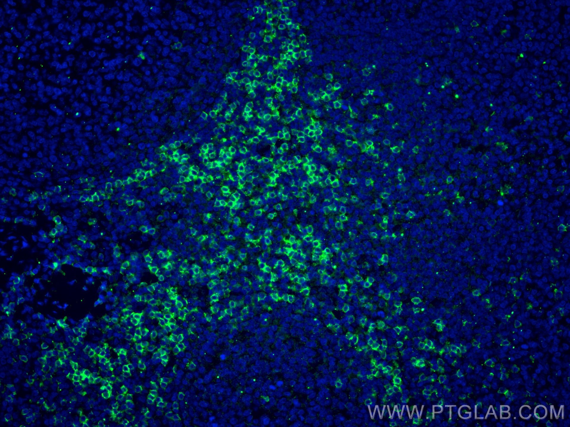 Immunofluorescence (IF) / fluorescent staining of human tonsillitis tissue using CoraLite® Plus 488-conjugated CD8a Monoclonal anti (CL488-66868)