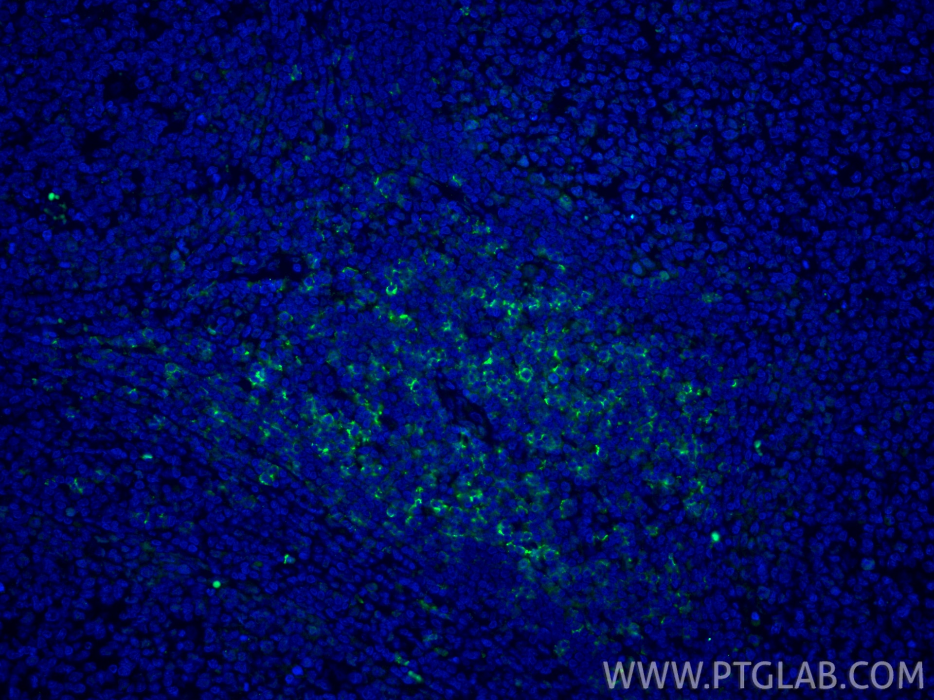 Immunofluorescence (IF) / fluorescent staining of human tonsillitis tissue using CoraLite® Plus 488-conjugated CD8a Recombinant mon (CL488-86063-2)