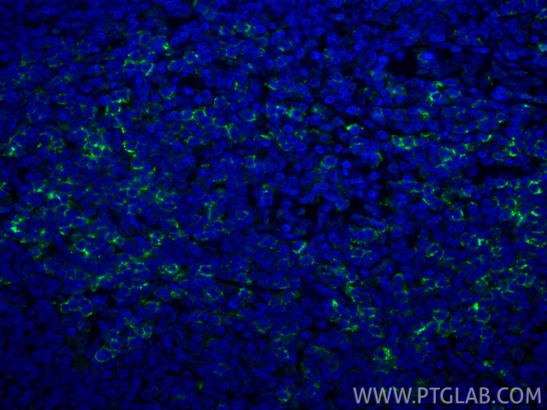 Immunofluorescence (IF) / fluorescent staining of human tonsillitis tissue using CoraLite® Plus 488-conjugated CD8a Recombinant mon (CL488-86063-2)