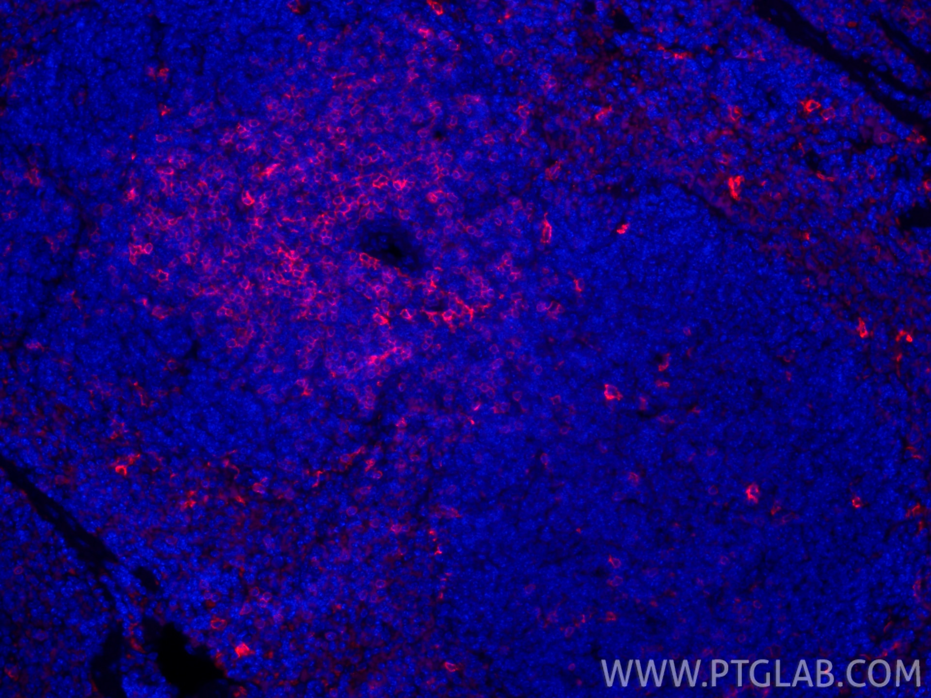 Immunofluorescence (IF) / fluorescent staining of mouse spleen tissue using CoraLite®594-conjugated CD8a Recombinant monoclona (CL594-85977-4)