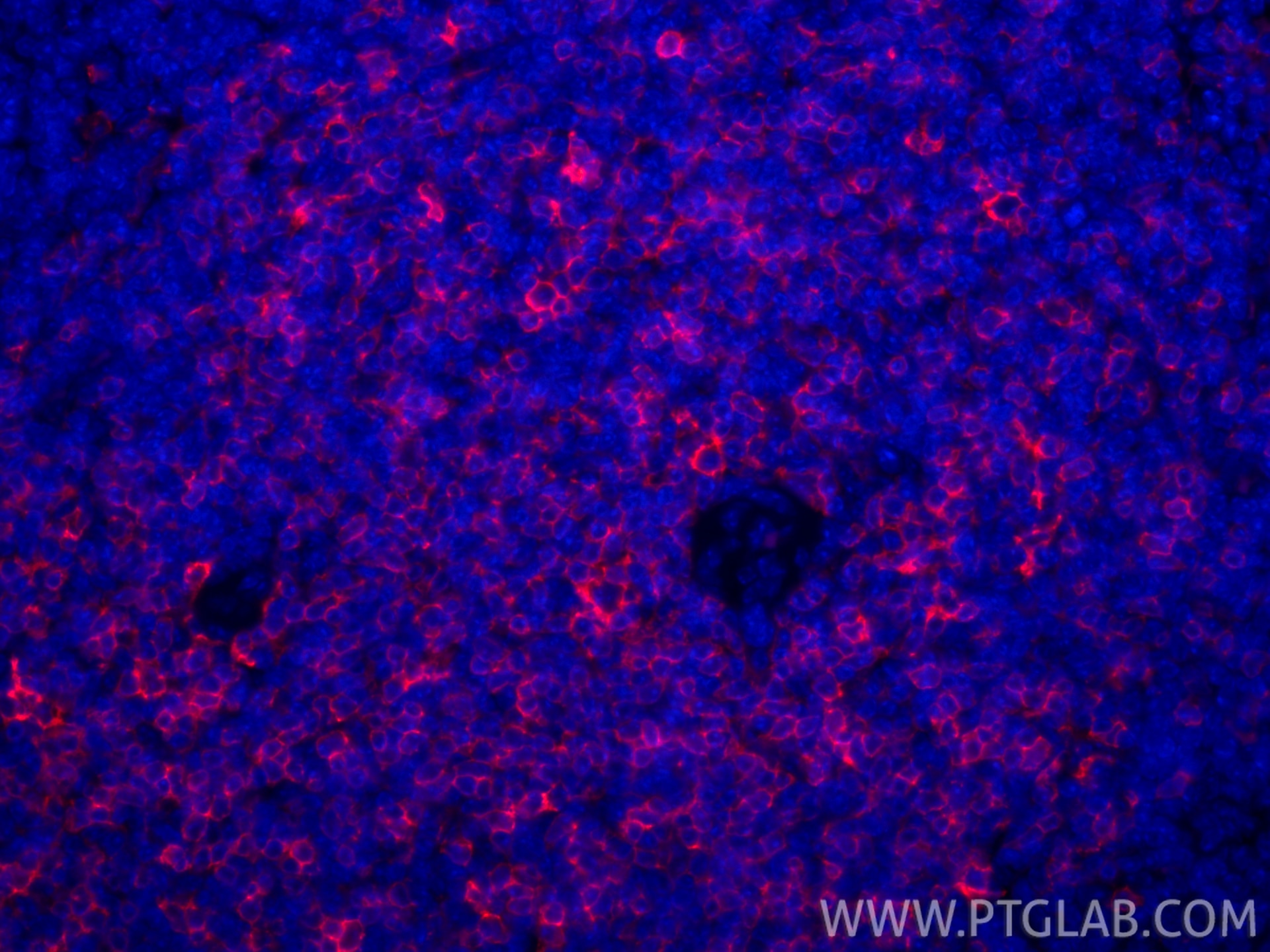 Immunofluorescence (IF) / fluorescent staining of mouse spleen tissue using CoraLite®594-conjugated CD8a Recombinant monoclona (CL594-85977-4)
