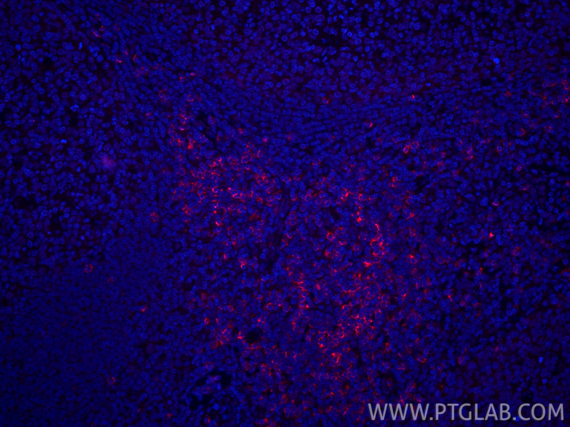 Immunofluorescence (IF) / fluorescent staining of human tonsillitis tissue using CoraLite®594-conjugated CD8a Recombinant monoclona (CL594-86063-2)