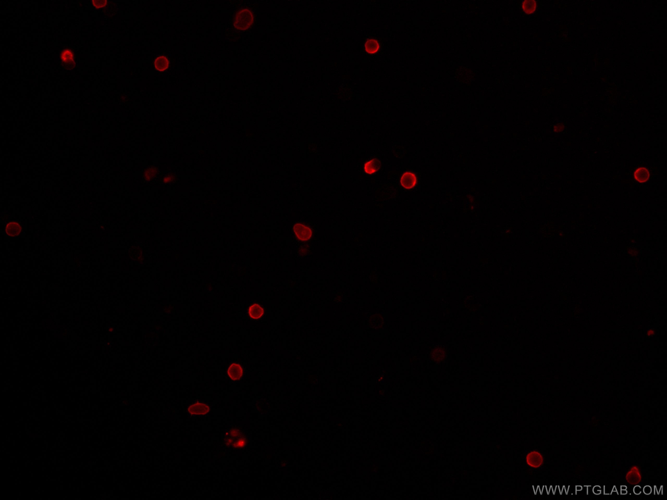 IF Staining of mouse splenocytes using CL647-65069