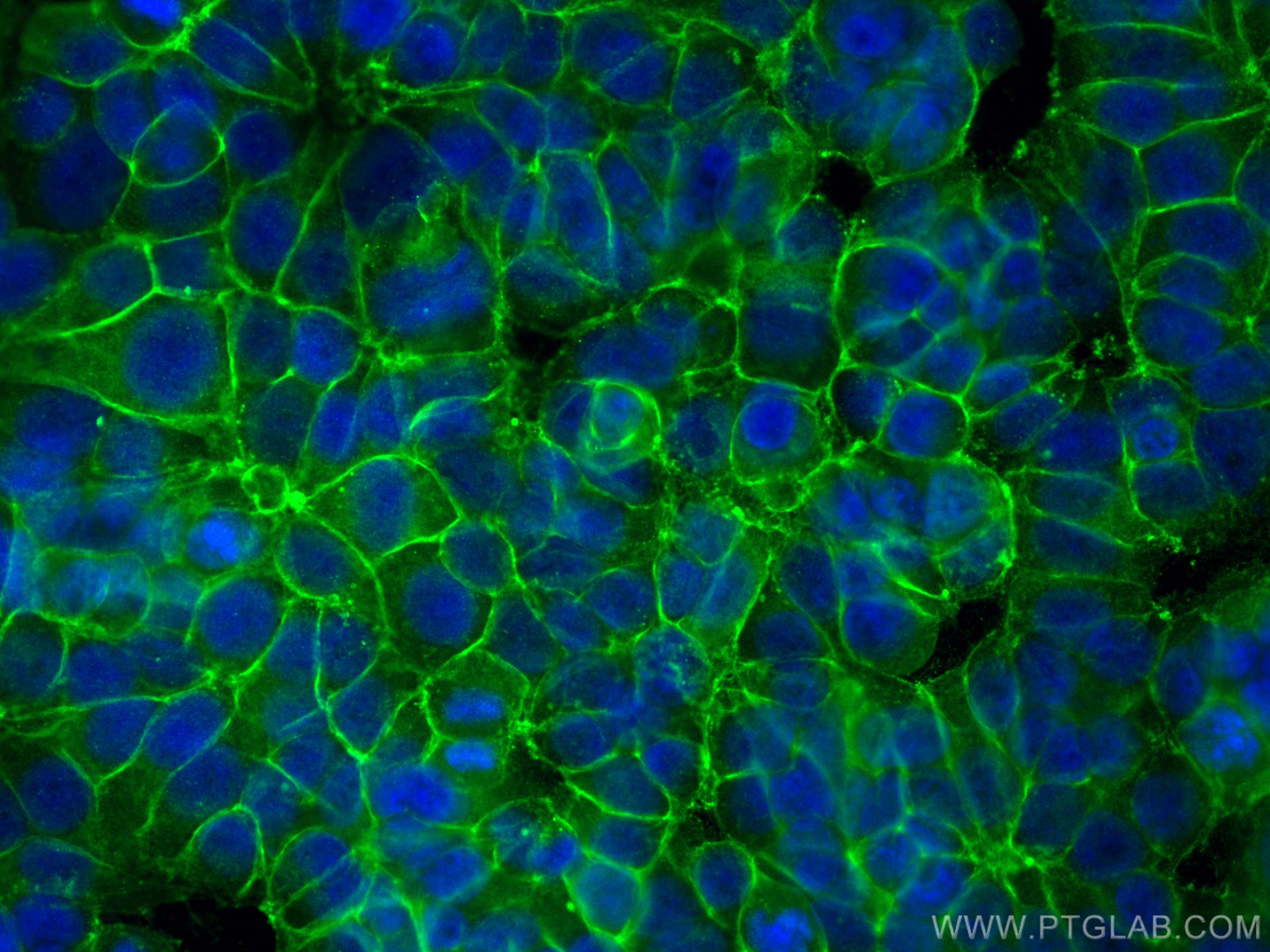 Immunofluorescence (IF) / fluorescent staining of MCF-7 cells using CD9 Polyclonal antibody (20597-1-AP)