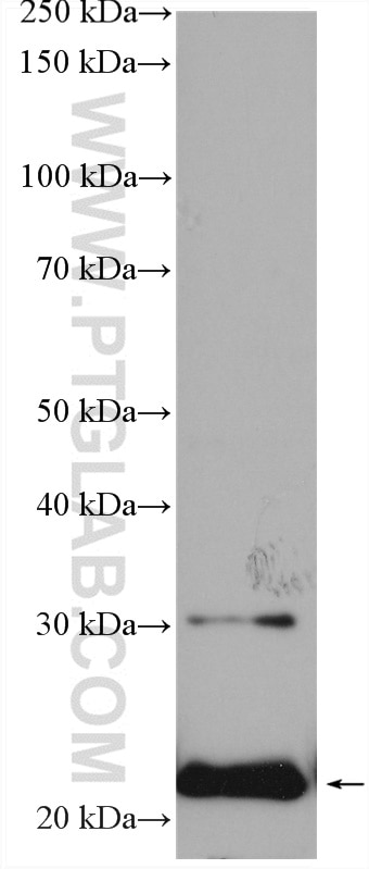 WB analysis of mouse placenta using 20597-1-AP