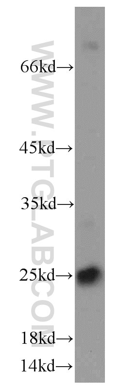 CD9 Polyclonal antibody