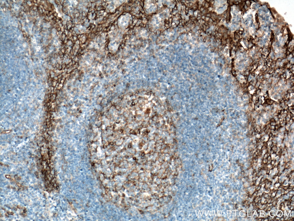 Immunohistochemistry (IHC) staining of human tonsillitis tissue using CD9 Monoclonal antibody (60232-1-Ig)