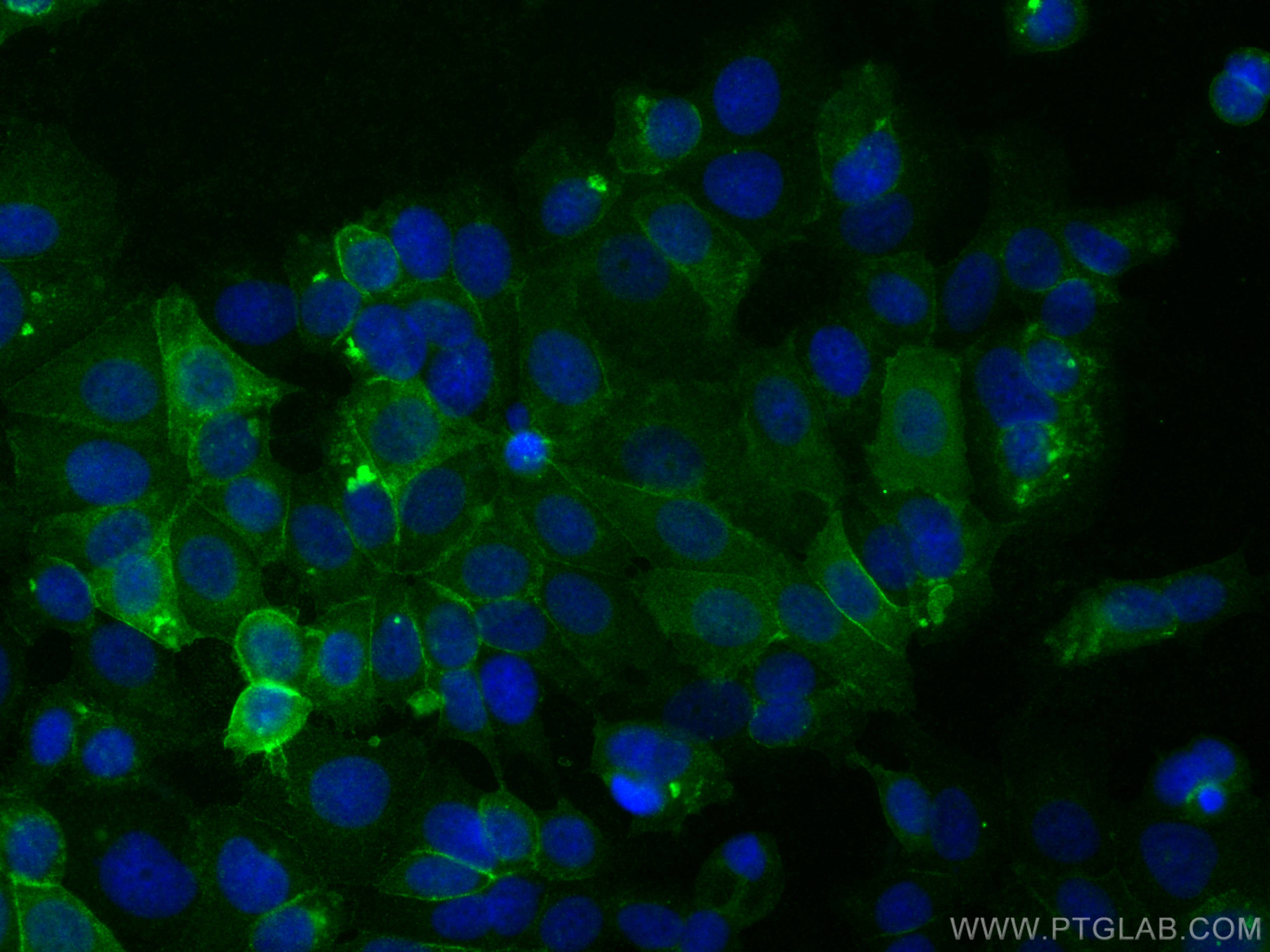 Immunofluorescence (IF) / fluorescent staining of MCF-7 cells using CD9 Recombinant antibody (82105-1-RR)