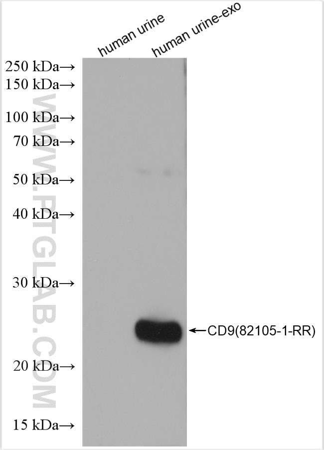 Western Blot (WB) analysis of human urine exosomes tissue using CD9 Recombinant antibody (82105-1-RR)