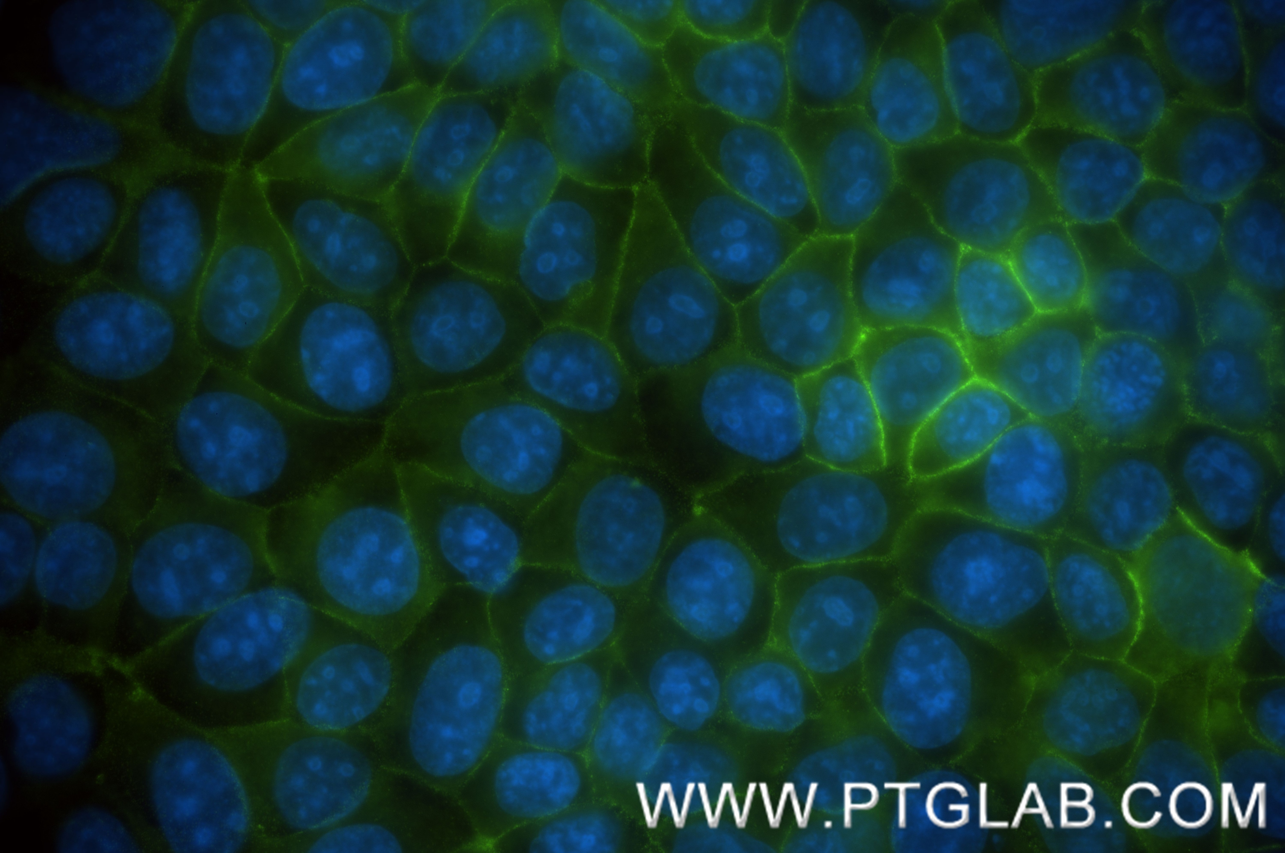 Immunofluorescence (IF) / fluorescent staining of MCF-7 cells using CD9 Recombinant monoclonal antibody (84142-1-RR)