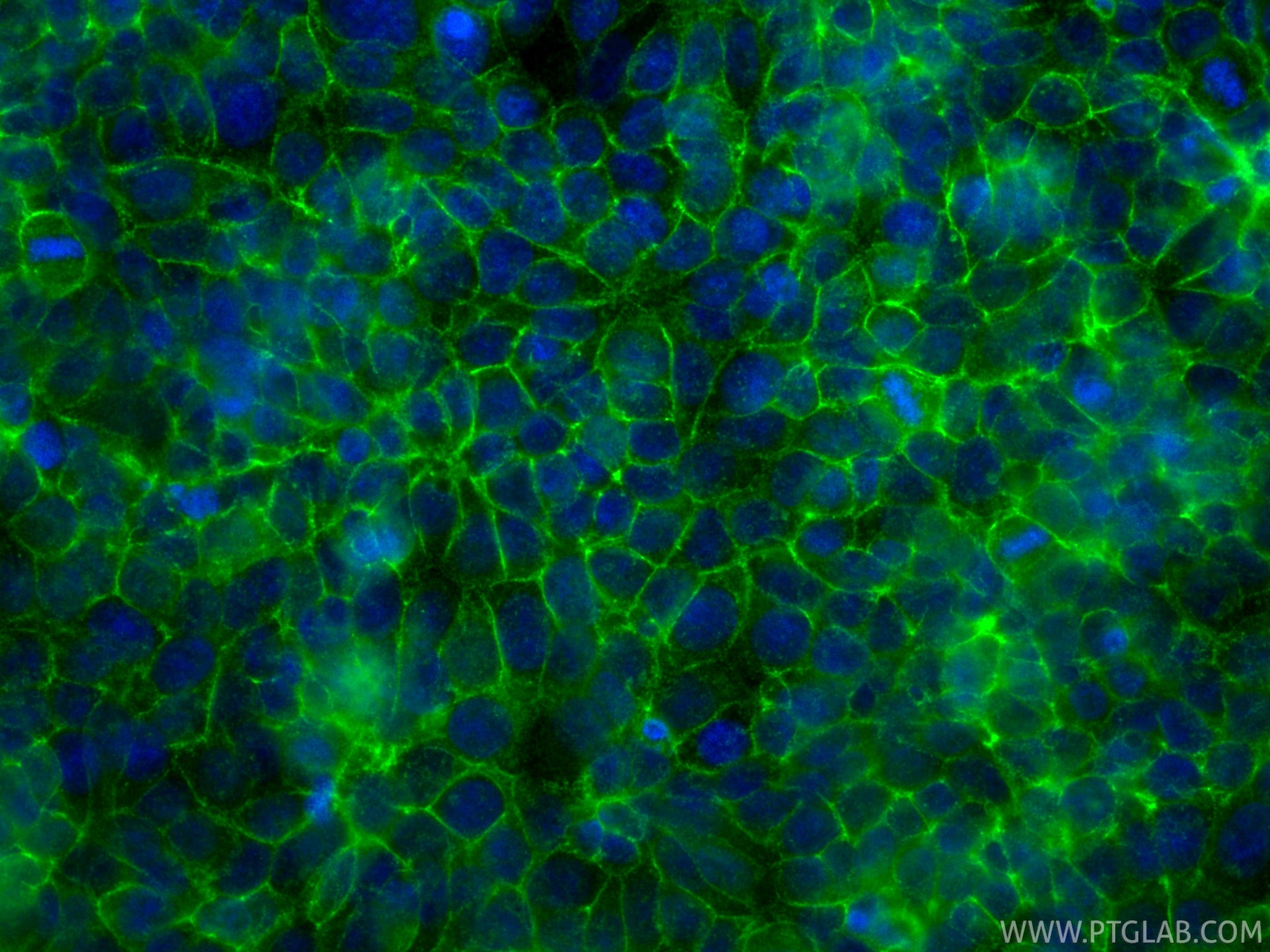 IF Staining of MCF-7 using 84142-1-RR Immunofluorescence (IF) / fluorescent staining of MCF-7 cells using CD9 Recombinant monoclonal antibody (84142-1-RR)