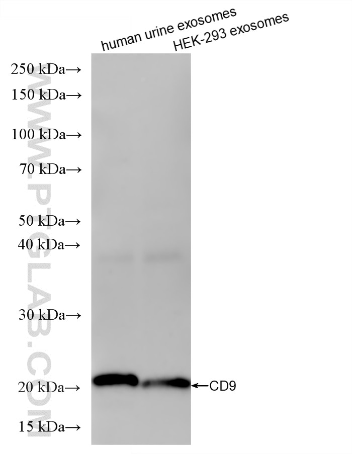Western Blot (WB) analysis of various lysates using CD9 Recombinant monoclonal antibody (84142-1-RR)