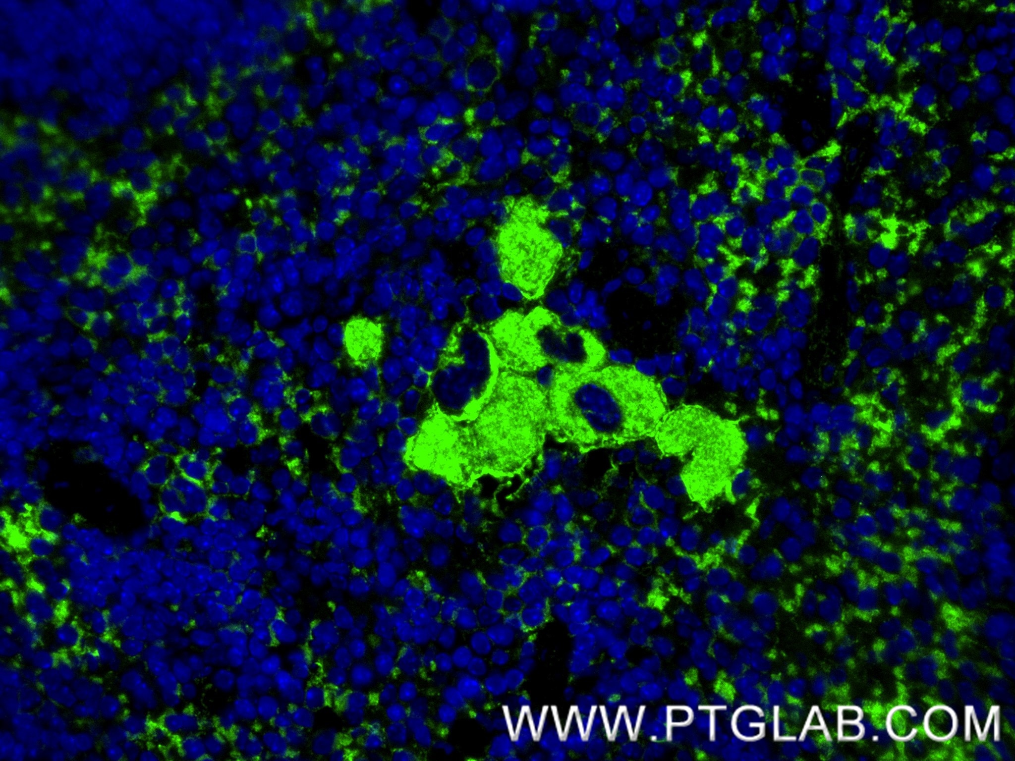 Immunofluorescence (IF) / fluorescent staining of mouse spleen tissue using CD9 Recombinant antibody (84801-13-RR)