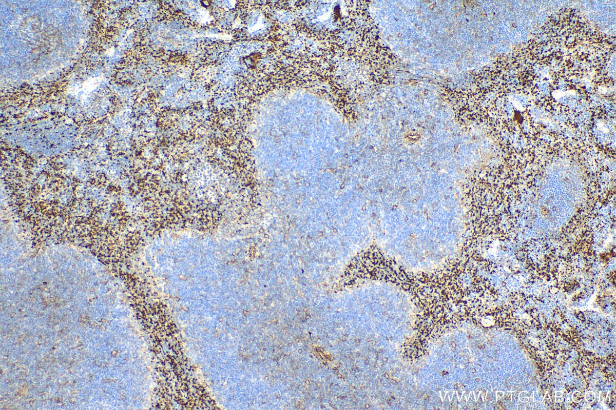 Immunohistochemistry (IHC) staining of mouse spleen tissue using CD9 Recombinant antibody (84801-13-RR)