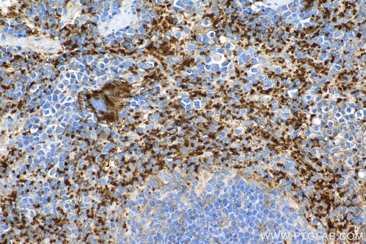 Immunohistochemistry (IHC) staining of mouse spleen tissue using CD9 Recombinant antibody (84801-13-RR)