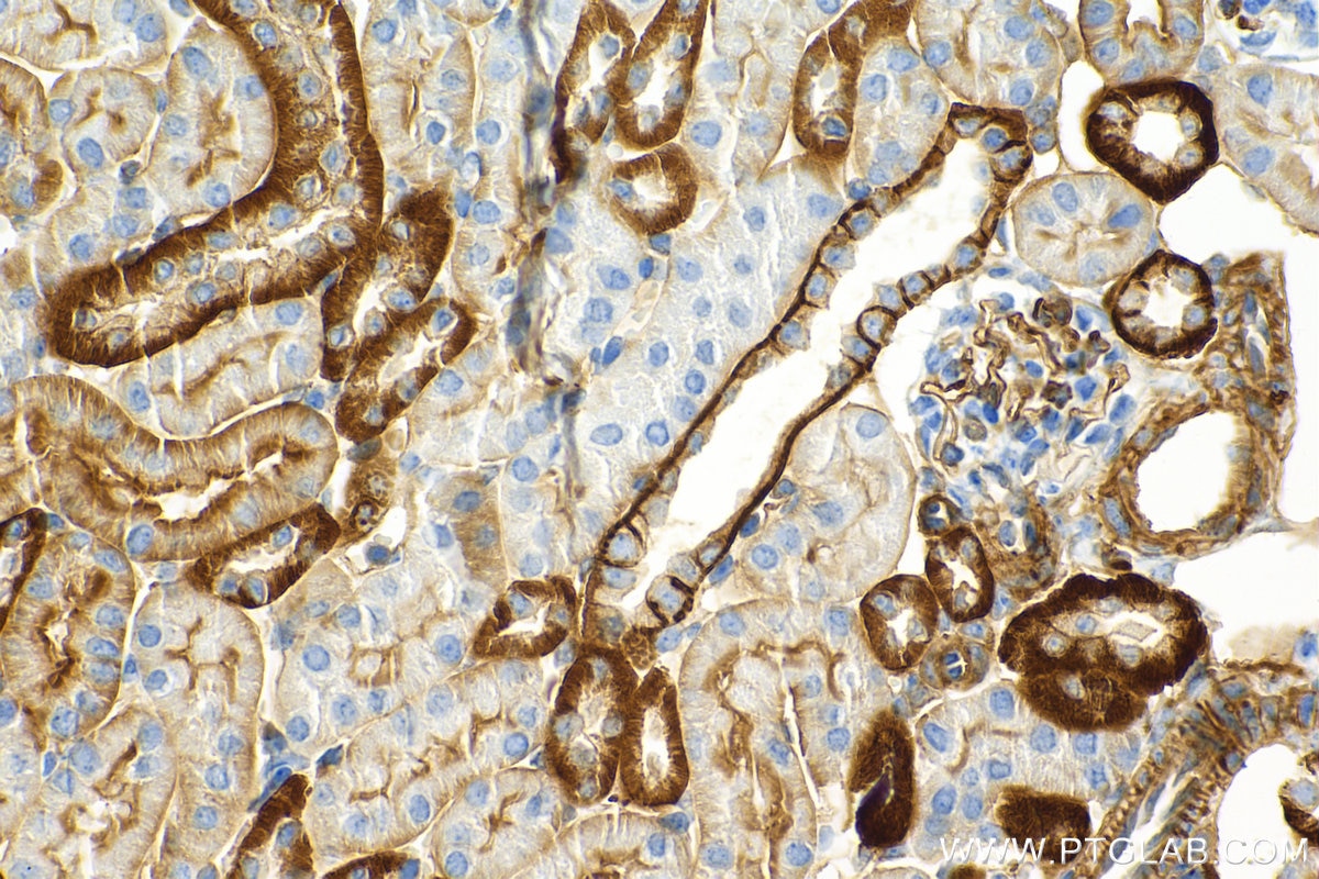 Immunohistochemistry (IHC) staining of mouse kidney tissue using CD9 Recombinant antibody (84801-13-RR)