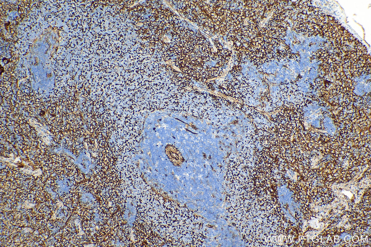 Immunohistochemistry (IHC) staining of rat spleen tissue using CD9 Recombinant antibody (84801-13-RR)