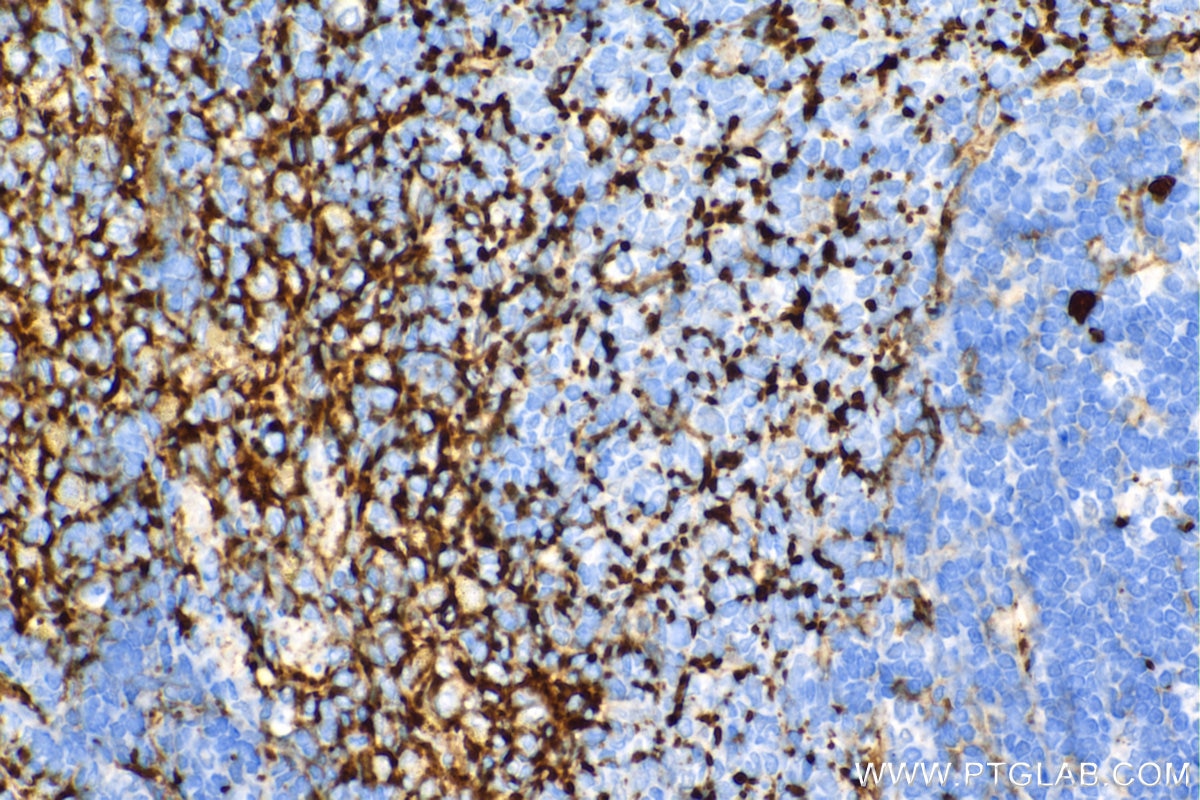 Immunohistochemistry (IHC) staining of rat spleen tissue using CD9 Recombinant antibody (84801-13-RR)