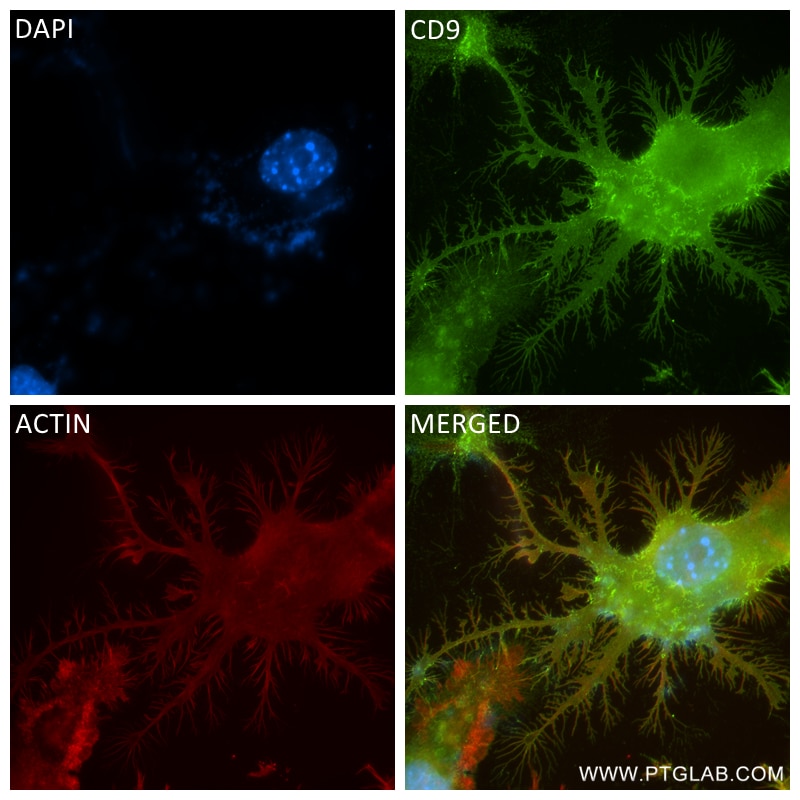 Immunofluorescence (IF) / fluorescent staining of RAW 264.7 cells using CD9 Recombinant antibody (84801-4-RR)