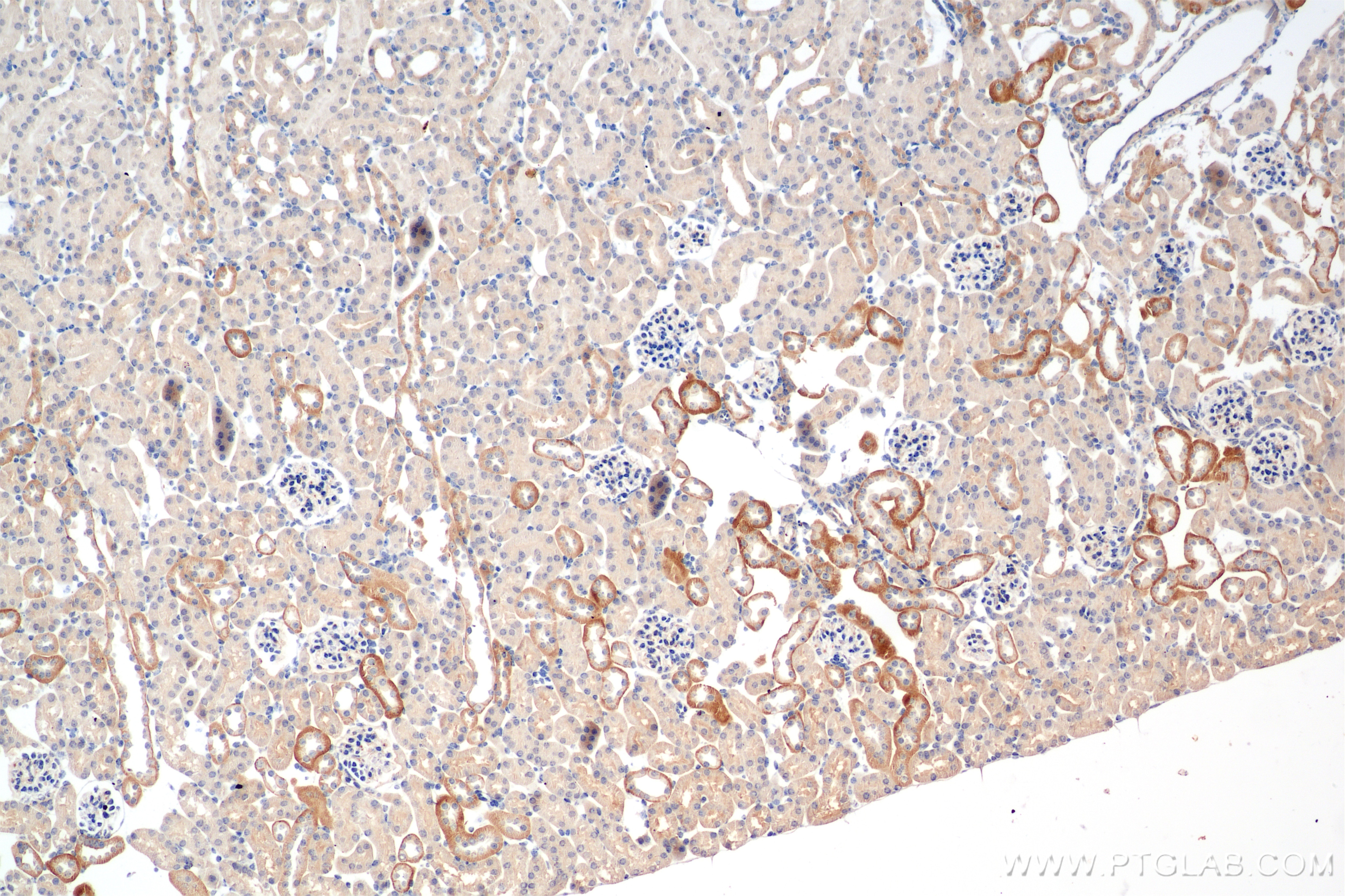 Immunohistochemistry (IHC) staining of mouse kidney tissue using CD9 Recombinant antibody (84801-4-RR)