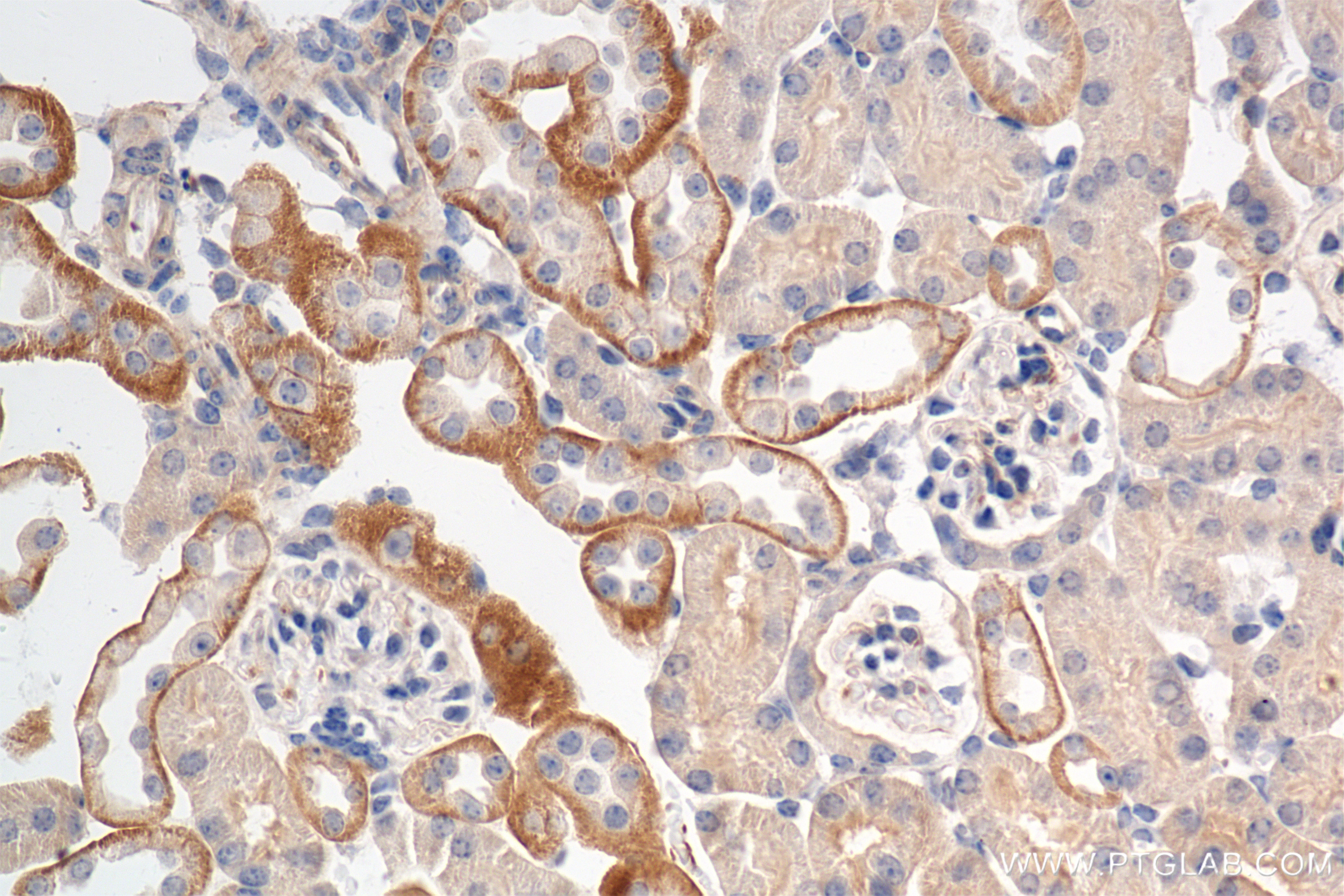 Immunohistochemistry (IHC) staining of mouse kidney tissue using CD9 Recombinant antibody (84801-4-RR)