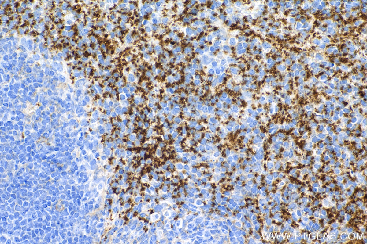 Immunohistochemistry (IHC) staining of mouse spleen tissue using CD9 Recombinant antibody (84801-5-RR)