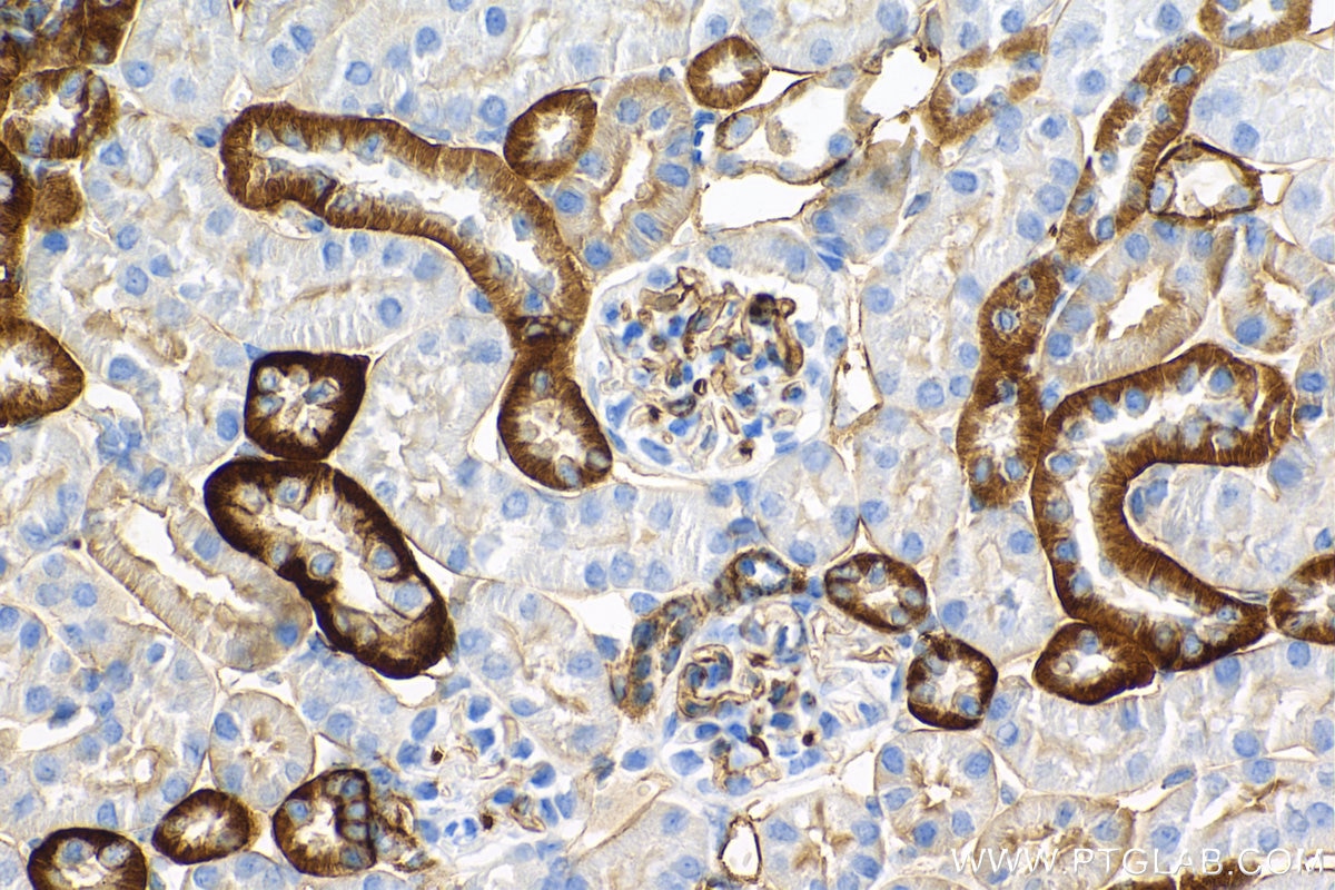 Immunohistochemistry (IHC) staining of mouse kidney tissue using CD9 Recombinant antibody (84801-5-RR)