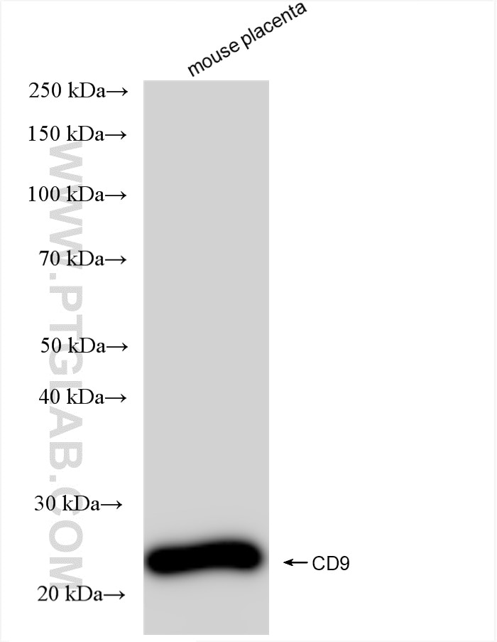 Western Blot (WB) analysis of mouse placenta tissue using CD9 Recombinant antibody (84801-5-RR)