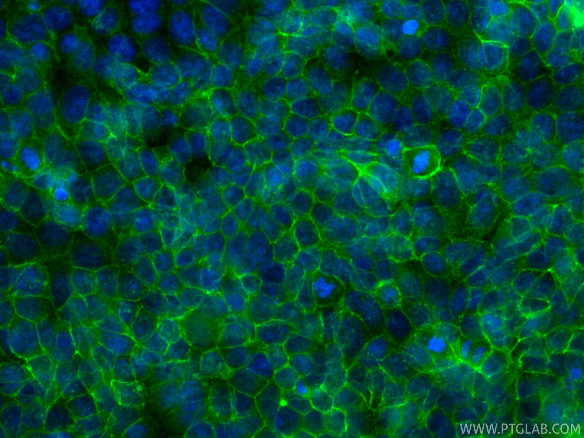 IF Staining of MCF-7 using CL488-84142 Immunofluorescence (IF) / fluorescent staining of MCF-7 cells using CoraLite® Plus 488-conjugated CD9 Recombinant mono (CL488-84142)