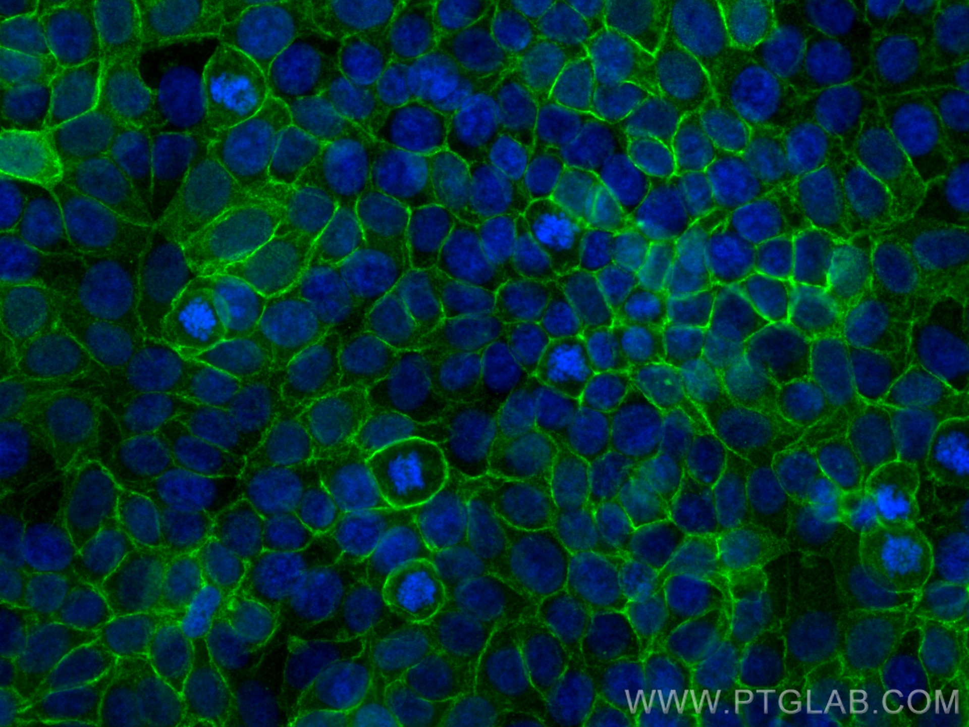 Immunofluorescence (IF) / fluorescent staining of MCF-7 cells using Multi-rAb™ CD9 Multi-Recombinant antibody (RMX00018)
